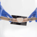 Find a Stress-Free Smile With Nitrous Oxide in San Antonio