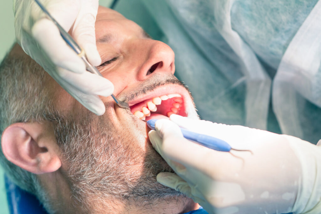 Loose Adult Tooth in San Antonio: Can It Be Saved?
