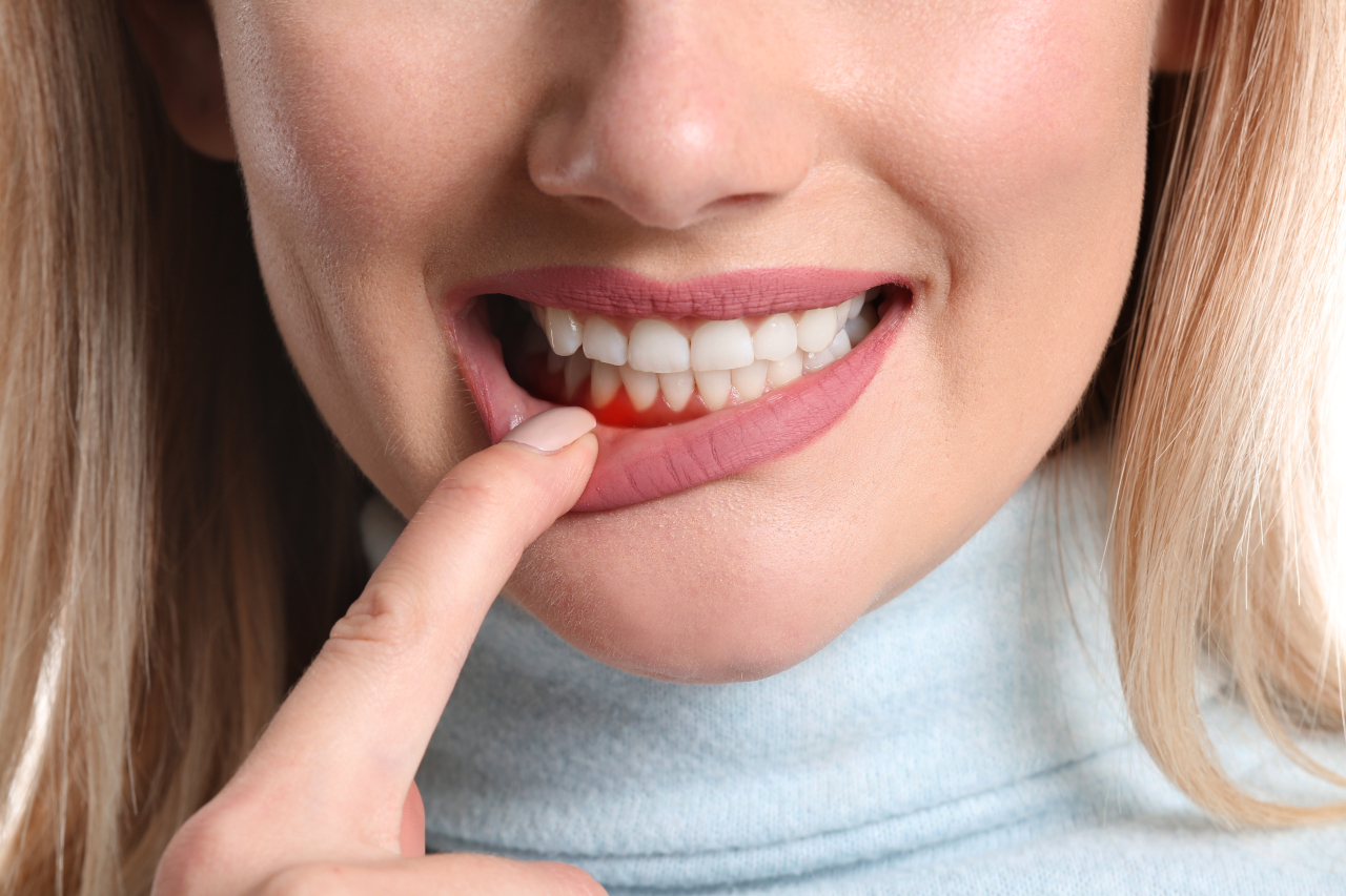 Why Are My Gums Bleeding? A San Antonio Dentist Explains